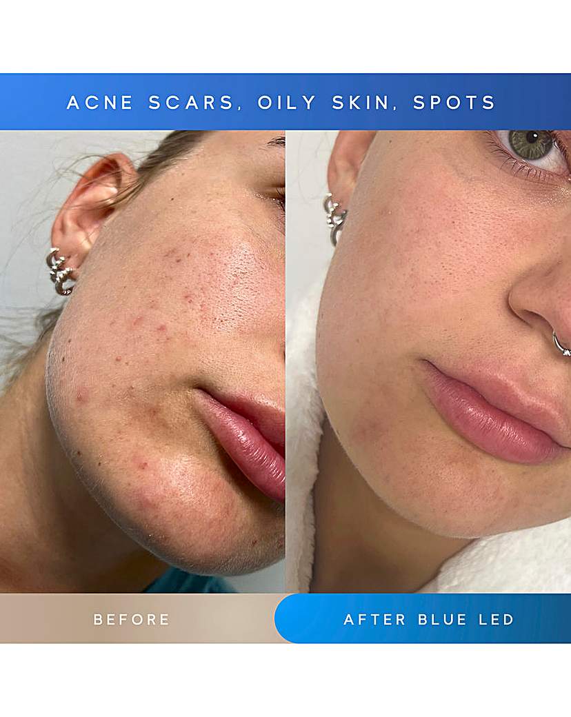 SENSSE ELITE 8 LIGHT MASK