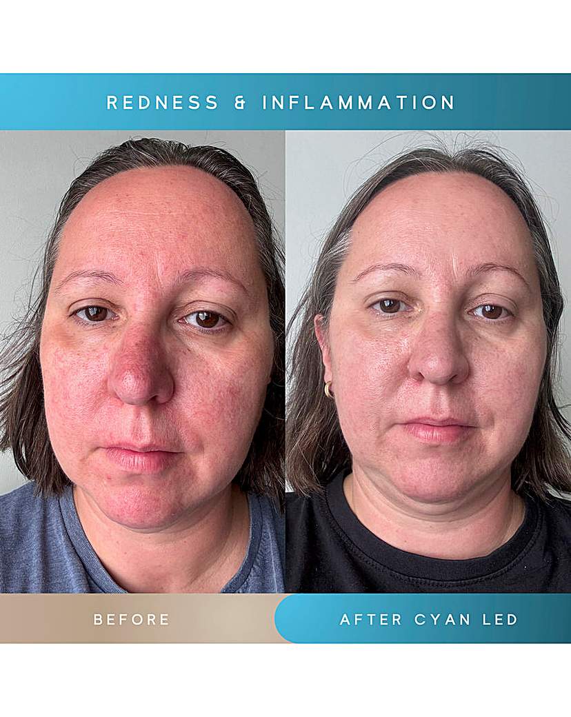 SENSSE ELITE 8 LIGHT MASK
