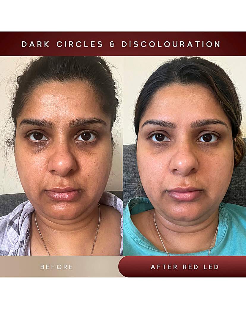 SENSSE ELITE 8 LIGHT MASK