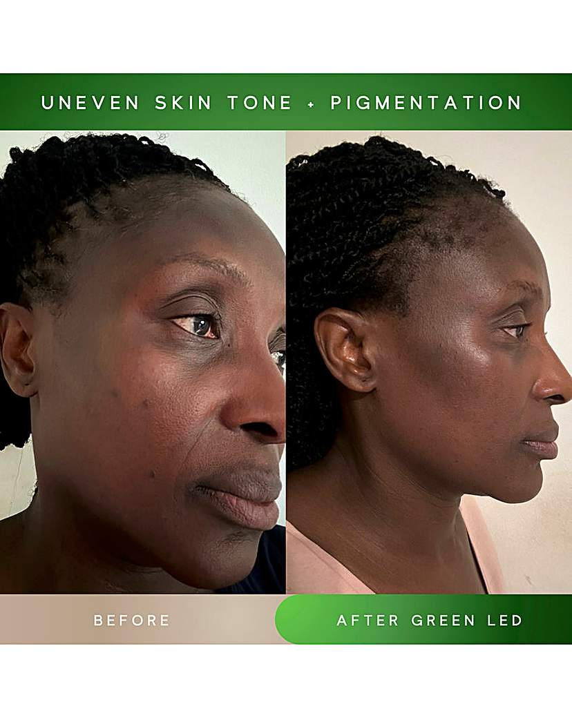 SENSSE ELITE 8 LIGHT MASK