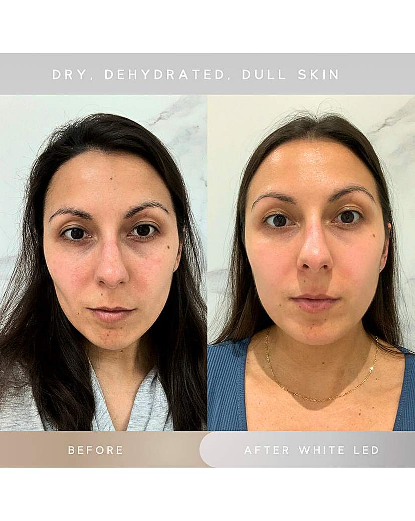 SENSSE ELITE 8 LIGHT MASK